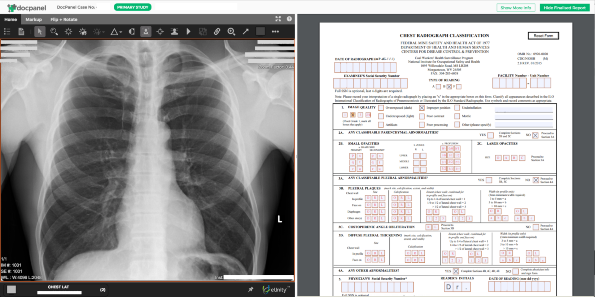 NIOSH “B Reading” is now online and efficient with DocPanel 1