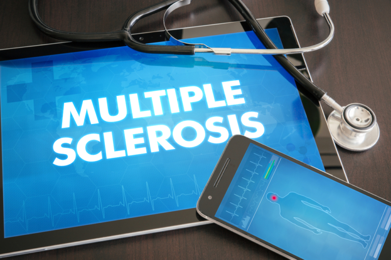 Why a Second Opinion is Crucial for a Multiple Sclerosis Diagnosis