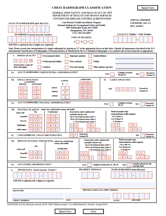 NIOSH “B Reading” is now online and efficient with DocPanel