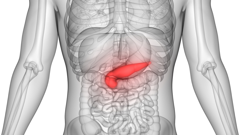 Pancreatic Cyst: Types