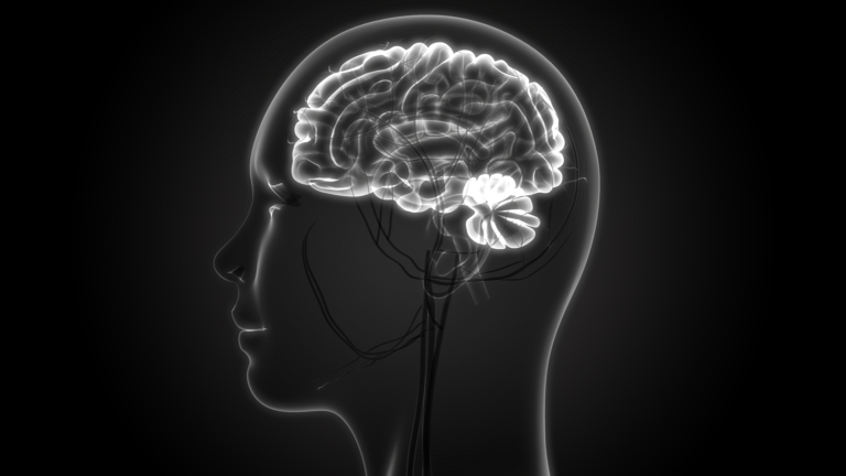 Navigating a White Matter Disease Diagnosis