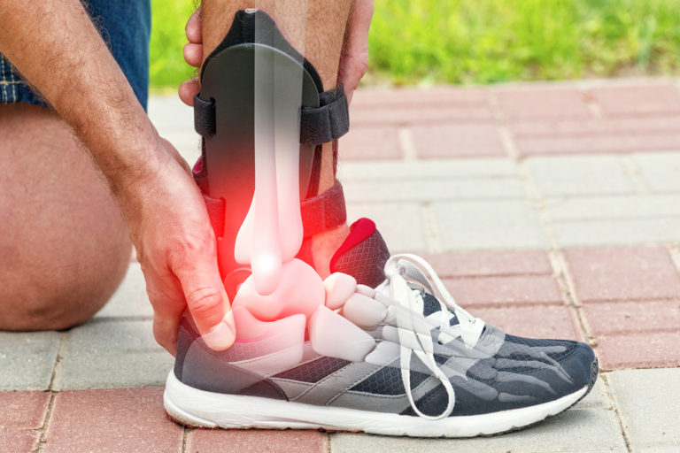 Sports Injury Diagnosis - Why You Should Get a Second Opinion