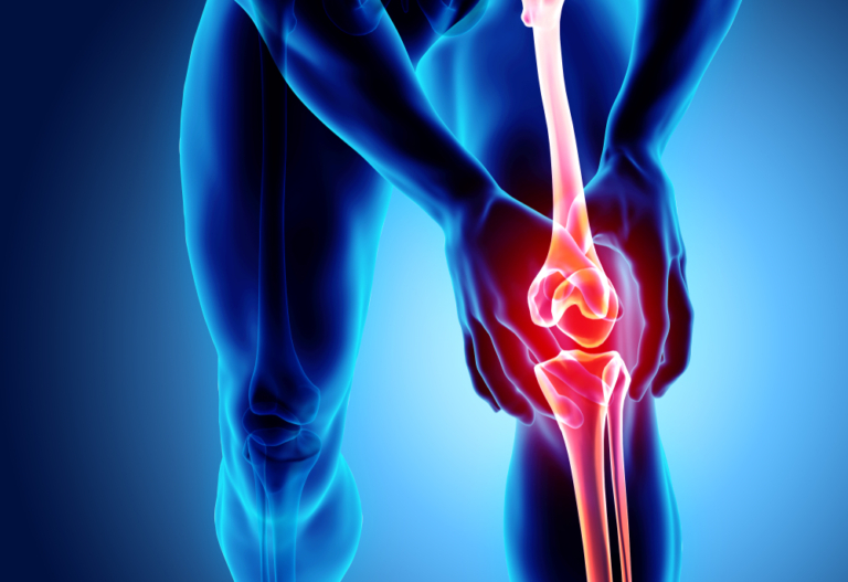 What You Should Know About Your Knee MRI