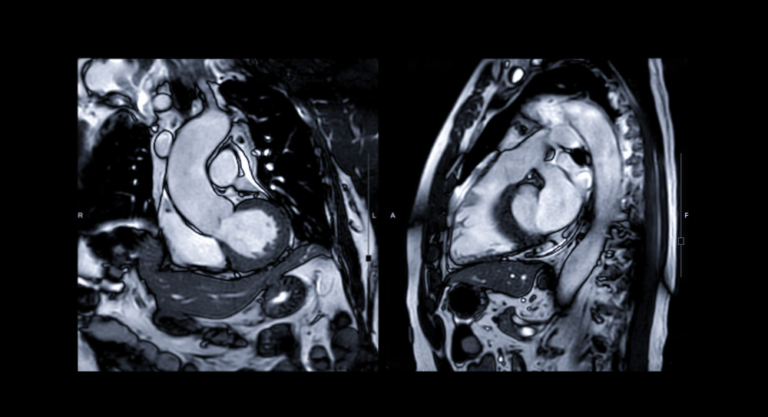 How Any Imaging Center Can Offer Cardiac MRI