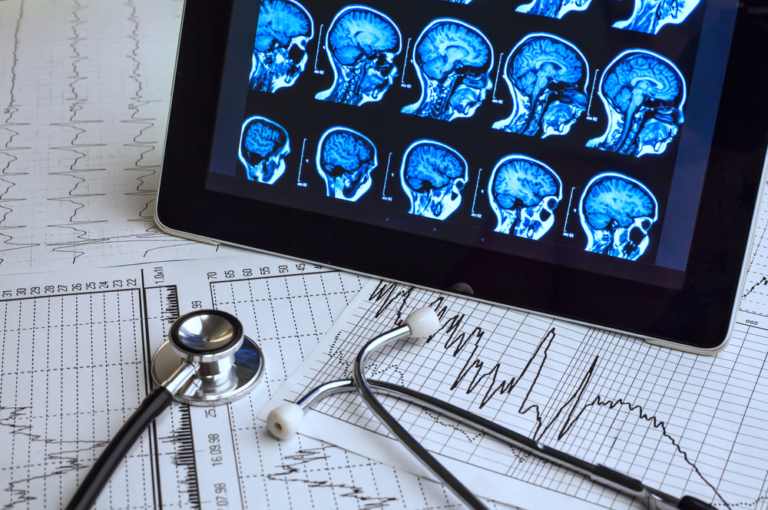 Top 3 Questions Patients Have About Their Neck and Brain Scans