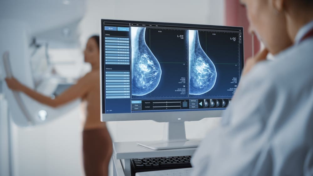 Breast Imaging