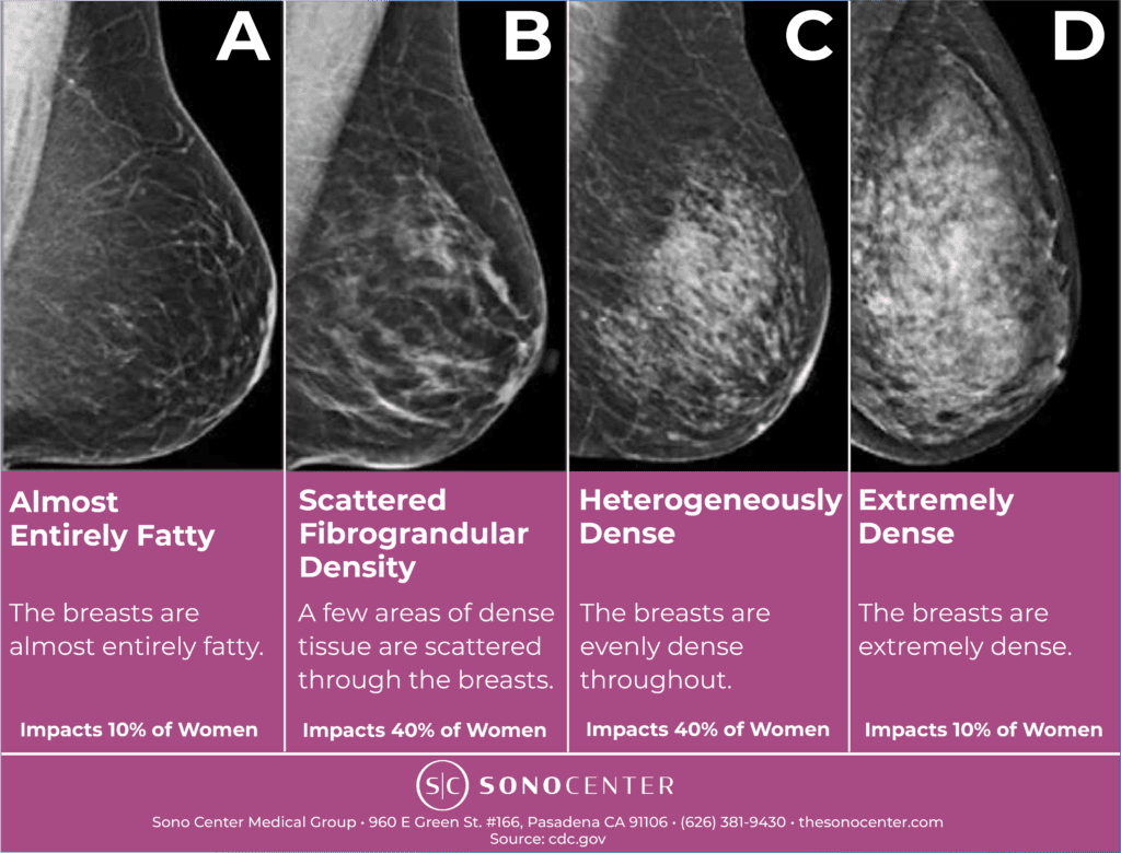 Breast Density Categories 