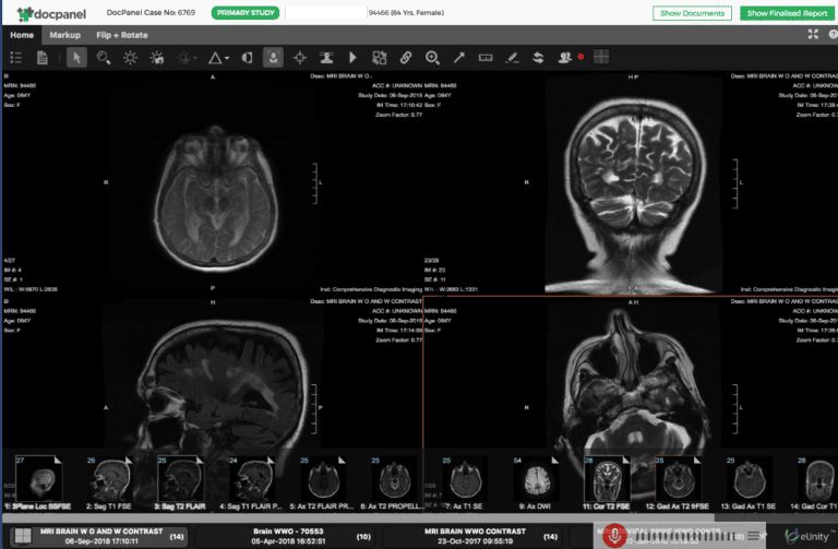 eUnity Smartviewer Helps DocPanel Create Disruptive Radiology Marketplace Experience