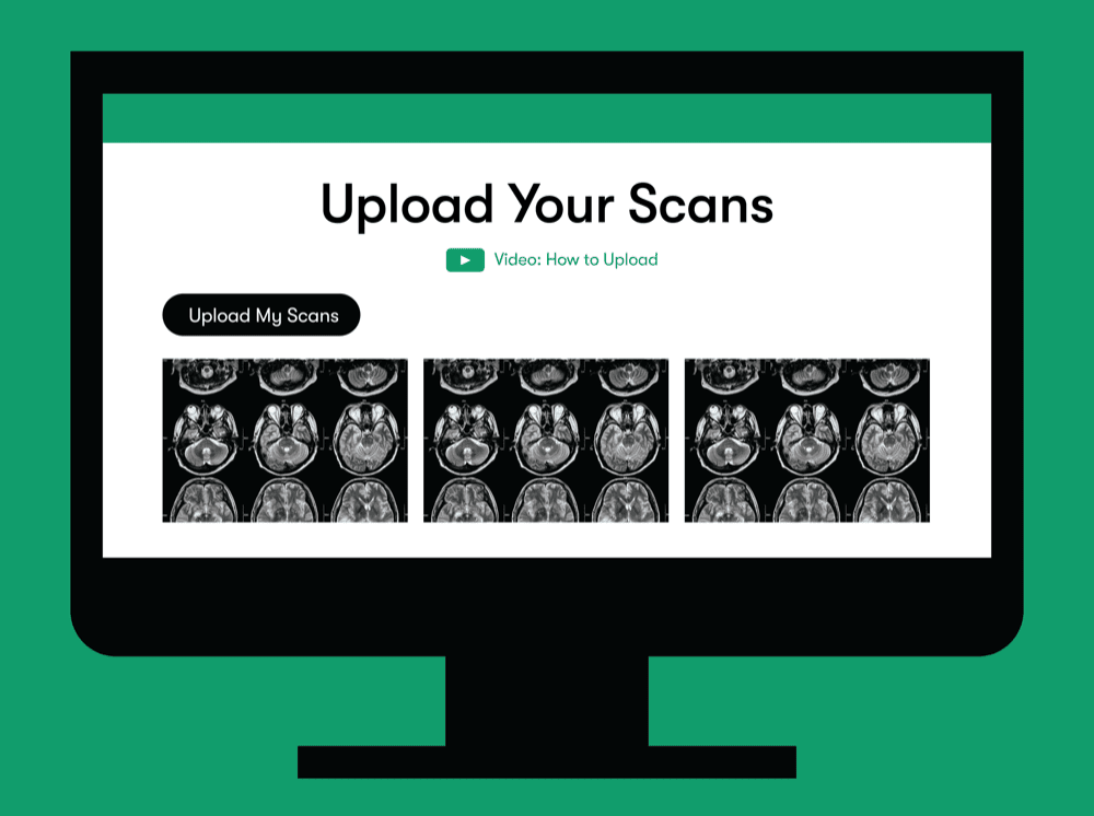 Step 1 Upload Your Scans